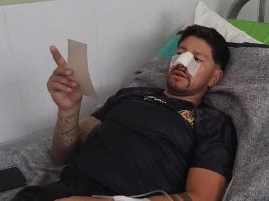 Brutal agresión a un árbitro en la Liga de Veteranos de La Paz